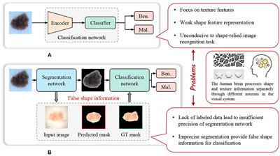 STNet: shape and texture joint learning through two-stream network for knowledge-guided image recognition